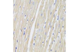 Immunohistochemistry (Paraffin-embedded Sections) (IHC (p)) image for anti-Fission 1 (FIS1) (AA 1-122) antibody (ABIN6140642)