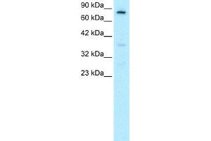 WB Suggested Anti-FOXE3 Antibody Titration:  0. (FOXE3 antibody  (C-Term))