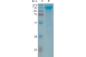 GPR64 Protein (AA 38-627) (His tag)