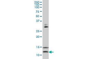 VAMP1 monoclonal antibody (M02), clone 5A4 Western Blot analysis of VAMP1 expression in HepG2 . (VAMP1 antibody  (AA 28-96))