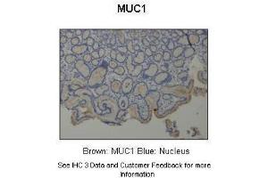 Sample Type :  Human stomach  Primary Antibody Dilution :  1:500  Secondary Antibody :  Anti-rabbit-HRP  Secondary Antibody Dilution :  1:1000  Color/Signal Descriptions :  Brown: MUC1 Blue: Nucleus  Gene Name :  MUC1  Submitted by :  Dr. (MUC1 antibody  (C-Term))