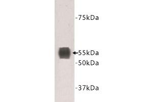 Western Blotting (WB) image for anti-Transmembrane Protein 132A (TMEM132A) antibody (ABIN1854988) (TMEM132A antibody)