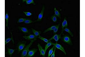 Immunofluorescent analysis of Hela cells using ABIN7143637 at dilution of 1:100 and Alexa Fluor 488-congugated AffiniPure Goat Anti-Rabbit IgG(H+L) (AKR1A1 antibody  (AA 2-325))