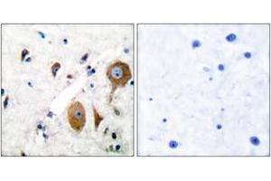 Immunohistochemistry analysis of paraffin-embedded human brain tissue, using mGluR8 Antibody. (GRM8 antibody  (AA 841-890))
