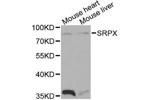 Western blot analysis of extracts of various cell lines, using SRPX antibody. (SRPX antibody)