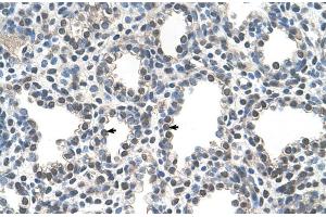 Human Lung (PPIB antibody  (Middle Region))
