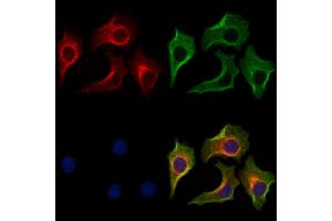 ABIN7094249 and ABIN7098296 staining HepG2 cells by IF/ICC.