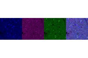 Immunohistochemistry (IHC) image for anti-Microtubule-Associated Protein 2 (MAP2) antibody (ABIN7456158)