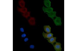 ABIN6258872 and ABIN6274907 staining Hela cells(45 min of heat-shock) by IF/ICC.
