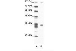 Image no. 1 for anti-PBX/knotted 1 Homeobox 2 (PKNOX2) (N-Term) antibody (ABIN202209) (PKNOX2 antibody  (N-Term))