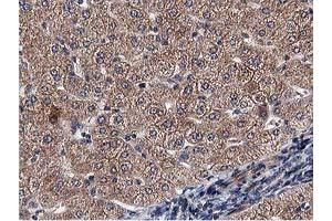 Immunohistochemical staining of paraffin-embedded Human liver tissue using anti-ACOT12 mouse monoclonal antibody. (ACOT12 antibody)