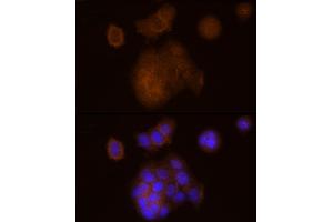 Immunofluorescence analysis of MCF7 cells using SOCS1 Rabbit mAb (ABIN7270640) at dilution of 1:100 (40x lens). (SOCS1 antibody)