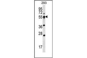 Western blot analysis of SMAP2 Antibody  in 293 cell line lysates (35ug/lane). (SMAP2 antibody  (Middle Region))