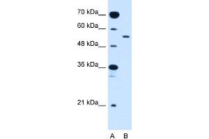 WB Suggested Anti-SLC2A10 Antibody Titration:  2. (SLC2A10 antibody  (Middle Region))