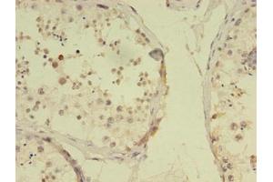 Immunohistochemistry of paraffin-embedded human testis tissue using ABIN7168313 at dilution of 1:100 (RBMY1F antibody  (AA 1-496))