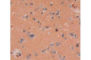 Used in DAB staining on fromalin fixed paraffin- embedded Kidney tissue (CHODL antibody  (AA 48-214))