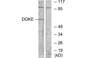 Western Blotting (WB) image for anti-Diacylglycerol Kinase, epsilon 64kDa (DGKE) (Internal Region) antibody (ABIN1849433) (DGKE antibody  (Internal Region))