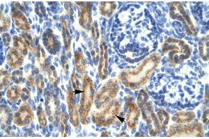 Rabbit Anti-HCLS1 Antibody ,Paraffin Embedded Tissue: Human Kidney  Cellular Data: Epithelial cells of renal tubule  Antibody Concentration: 4. (HCLS1 antibody  (N-Term))