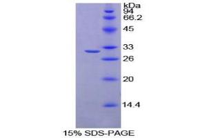 SDS-PAGE analysis of Rat Ribonuclease Inhibitor Protein.