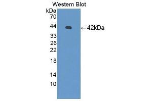 Detection of Recombinant SYT1, Human using Polyclonal Antibody to Synaptotagmin I (SYT1) (SYT1 antibody  (AA 136-422))