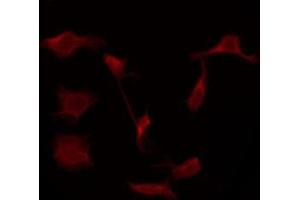 ABIN6276058 staining Hela by IF/ICC. (TACR1 antibody  (Internal Region))