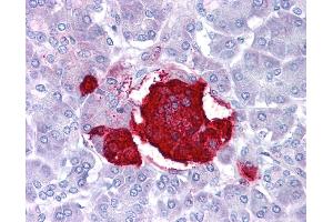 Leptin antibody was used for immunohistochemistry at a concentration of 4-8 ug/ml. (Leptin antibody  (Middle Region))
