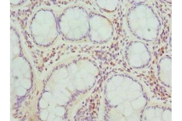 TARS antibody  (AA 1-230)