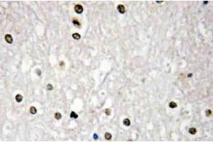 Immunohistochemistry (IHC) analyzes of p73 antibody in paraffin-embedded human brain tissue. (Tumor Protein p73 antibody)