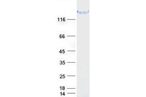 Validation with Western Blot (LRRFIP1 Protein (Transcript Variant 4) (Myc-DYKDDDDK Tag))