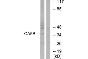 Western Blotting (WB) image for anti-Carbonic Anhydrase VB, Mitochondrial (CA5B) (C-Term) antibody (ABIN1851011) (CA5B antibody  (C-Term))