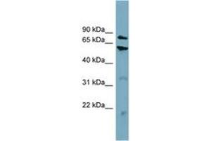 Image no. 1 for anti-Carnitine Palmitoyltransferase 1B (Muscle) (CPT1B) (AA 359-408) antibody (ABIN6743419)
