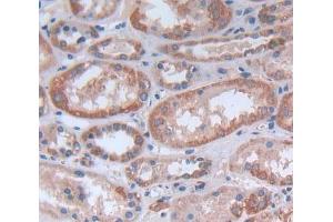 Used in DAB staining on fromalin fixed paraffin- embedded Kidney tissue (KTN1 antibody  (AA 1104-1357))