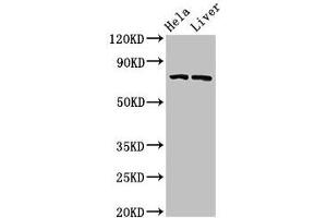 Western Blot Positive WB detected in: Hela whole cell lysate, Rat liver tissue All lanes: ACSL5 antibody at 3 μg/mL Secondary Goat polyclonal to rabbit IgG at 1/50000 dilution Predicted band size: 76, 83, 74, kDa Observed band size: 76 kDa (ACSL5 antibody  (AA 33-683))
