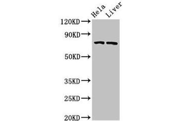 ACSL5 anticorps  (AA 33-683)
