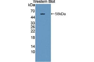 Detection of Recombinant THBS3, Human using Polyclonal Antibody to Thrombospondin 3 (THBS3) (THBS3 antibody  (AA 670-921))