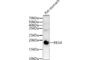 Western blot analysis of extracts of Rat stomach, using REG4 antibody (ABIN6132619, ABIN6146859, ABIN6146860 and ABIN6217007) at 1:1000 dilution.
