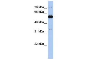 PHGDH antibody used at 1 ug/ml to detect target protein. (PHGDH antibody  (Middle Region))