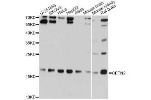 Western blot analysis of extracts of various cell lines, using CETN2 Antibody (ABIN1876585) at 1:1000 dilution. (CETN2 antibody)