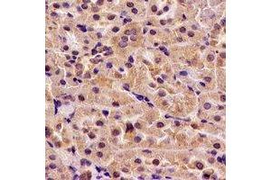 Immunohistochemical analysis of H6PD staining in rat kidney formalin fixed paraffin embedded tissue section. (Glucose-6-Phosphate Dehydrogenase antibody)