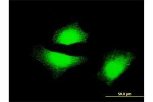 Immunofluorescence of monoclonal antibody to MAP2K5 on HeLa cell. (MAP2K5 antibody  (AA 1-120))