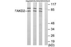 Western blot analysis of extracts from HuvEc/HepG2/COLO cells, using FAKD2 Antibody. (FASTKD2 antibody  (AA 171-220))