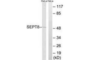 Western blot analysis of extracts from HeLa cells, using SEPT8 Antibody. (Septin 8 antibody  (AA 170-219))