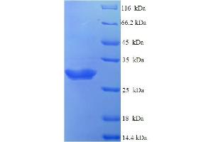 SDS-PAGE (SDS) image for Neutrophil Count (NEUT) (AA 24-143) protein (His-SUMO Tag) (ABIN5710029) (Neutrophil Count Protein (NEUT) (AA 24-143) (His-SUMO Tag))