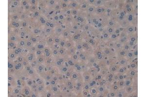 DAB staining on IHC-P; Samples: Mouse Liver Tissue (FIL1d antibody  (AA 1-156))
