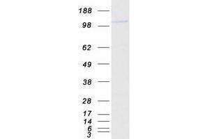 CC2D1B Protein (Myc-DYKDDDDK Tag)