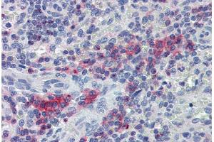 Immunohistochemistry staining of human spleen (paraffin sections) with anti-LIME polyclonal antibody. (LIME antibody  (AA 141-295))