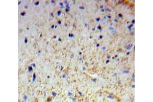 Used in DAB staining on fromalin fixed paraffin-embedded Brain tissue (OTUB1 antibody  (AA 1-271))