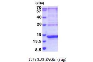 SDS-PAGE (SDS) image for Carcinoembryonic Antigen-Related Cell Adhesion Molecule 3 (CEACAM3) (AA 35-155) protein (His tag) (ABIN5853992)