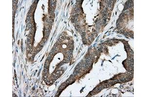 Immunohistochemical staining of paraffin-embedded liver tissue using anti-PRKAR2A mouse monoclonal antibody.