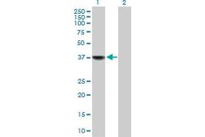 Western Blot analysis of BLVRA expression in transfected 293T cell line by BLVRA MaxPab polyclonal antibody. (Biliverdin Reductase antibody  (AA 1-296))